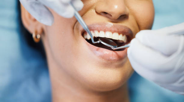Best Emergency Root Canal Treatment in Lake Holm, WA
