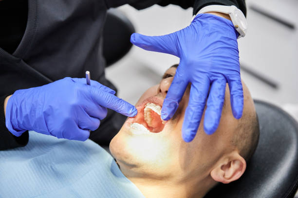 Best Broken or Cracked Tooth Emergency Dentist in Lake Holm, WA